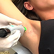  Skin Surgery kathmandu