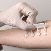 Skin Treatment Nepal