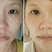 Plastic Surgery Kathmandu